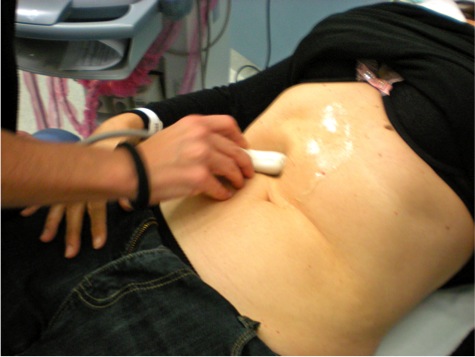  Ultrasonic Cavitation to Reduce Fats